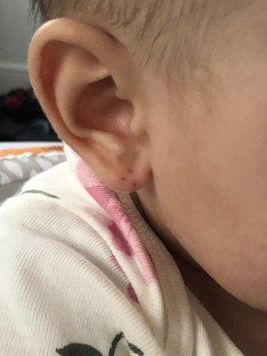 Two ear piercings in the complete wrong place