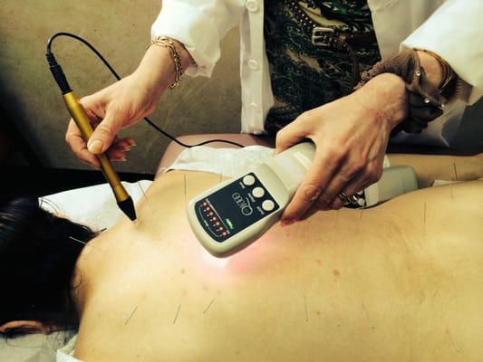 Cold Laser treatment