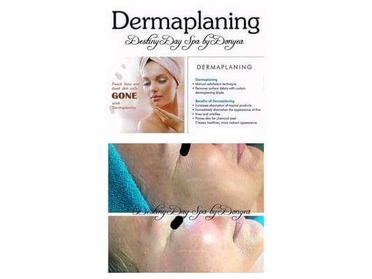 Before and after: Dermaplaning