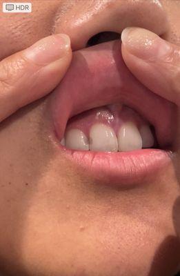 Previous fillings by Dr Headley