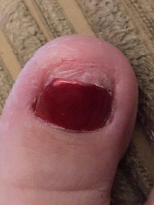 This is what my toenail looks like after this woman butchered it!