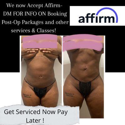 Payment option - pay later with affirm