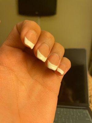 White color uneven and chipping.