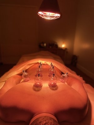 Back Pain Relief with Cupping and Infrared Light Therapy.