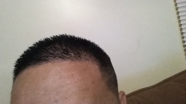 I asked for High skin fade and this is not a high, skin fade.