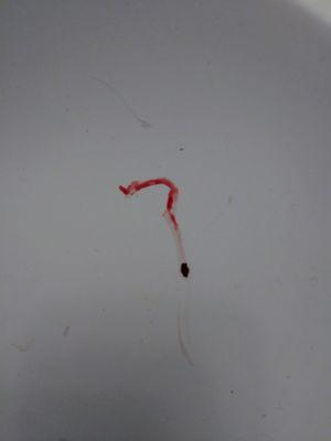 My blood...1 dead bedbug