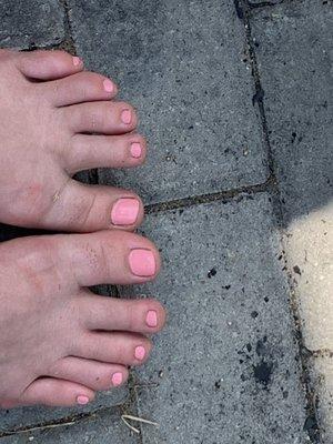 Uneven and messy toenails