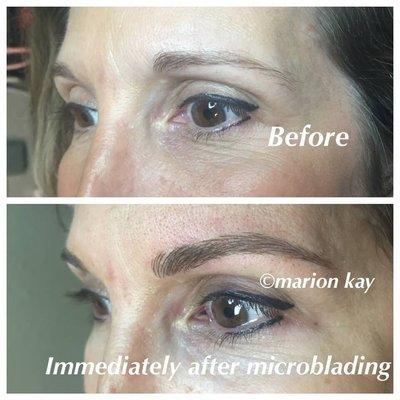 Before and immediately after microblading