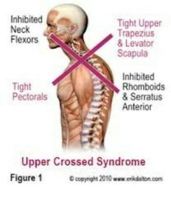 Thru a process in my work, can bring the neck & shoulders in more of up right alignment.