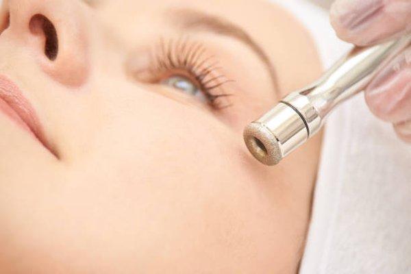 Diamond Tip Microdermabrasion.