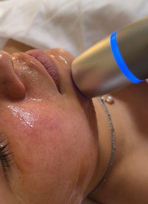 Cryo therapy reduces redness and inflammation