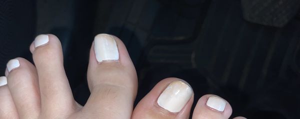 why are my 'white' toes brown ??? Within a couple of days.