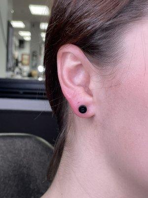 Stretched Lobe