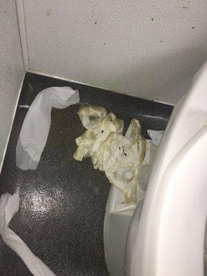 better view of the old urine soaked toilet paper wads