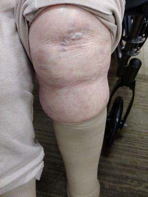 Supposed to be caring. Didn't know how to put on compression socks on residents.