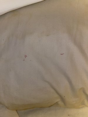 Blood stains on the pillows.