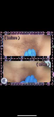 $40 BRAZILIAN WAXING