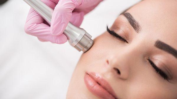 Microdermabrasion !!!