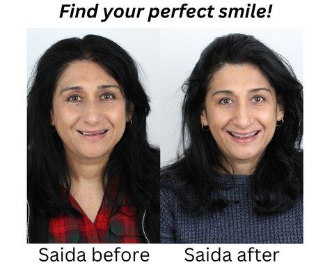 Find your perfect smile! whiteridgedental.com 
 801-942-7770