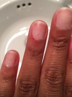 About an hour later and my nail is STILL bleeding. PLEASE do not go to this place.