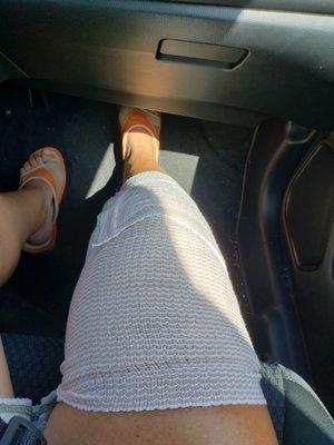 My knee after surgery.  Feeling good!