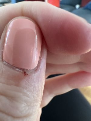 Cuticle cut from recent varnish lane friendship heights experience