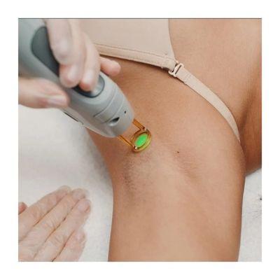 Underarm laser session