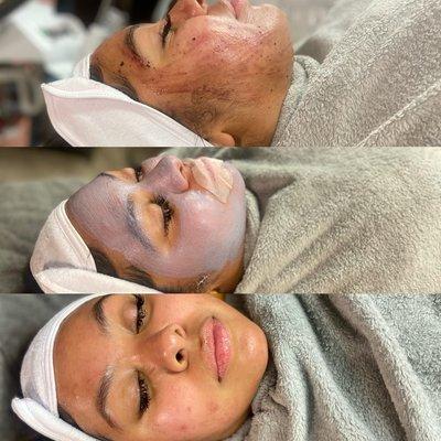 Very Berry Spring Facial