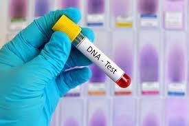 DNA Testing - Legal