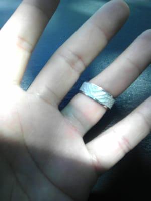 This is the stain this bad quality "silver"ring left on my finger. This was supposed to be my wedding band.