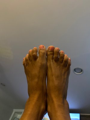 My dry short nailed feet