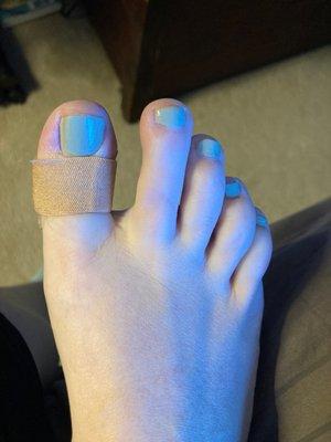 Messy toes and a bandage