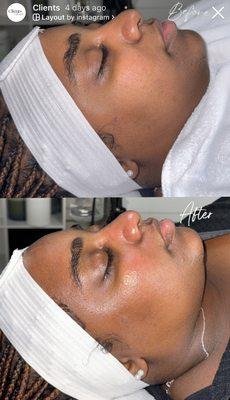 Maintenance Facial