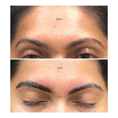 Microblading for improvement on definition