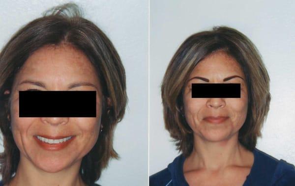 Permanent Eyebrows before and after pictures