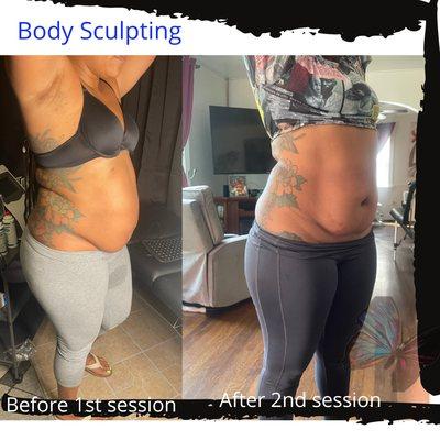 Results after 2 sessions of Body Sculpting*results very from person to person. Call for your free consultation