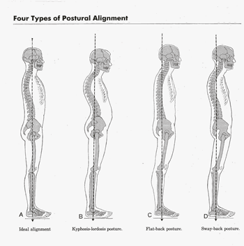 Posture Correction