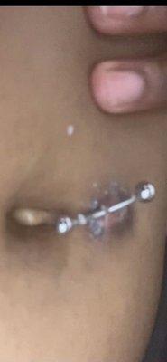 rejected bellybutton piercing