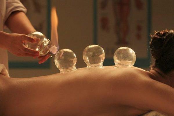 Cupping Therapy