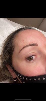 After Microblading