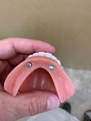 Little Rock Denture Lab