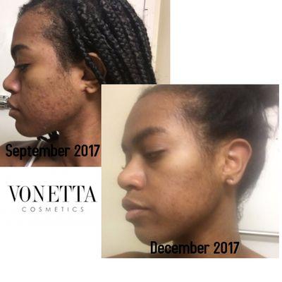 Client Progress in Three Months