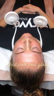 Post Chemical Peel