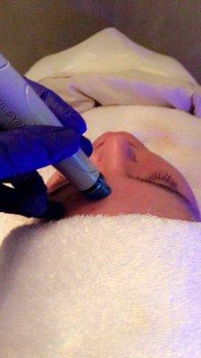 Hydrafacial MD