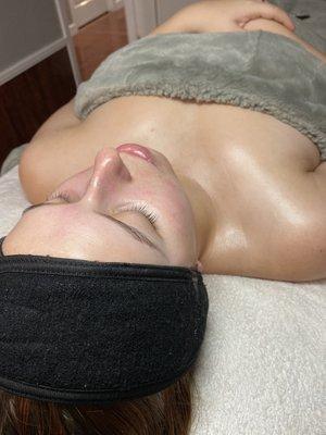 Dermaplaning Facial (this client has sensitive skin)