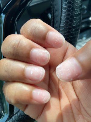 Damaged Nails