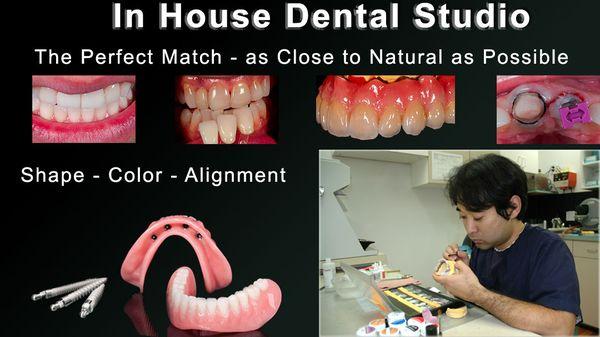 In-House Dental Studio