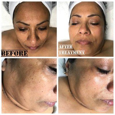 Anti-aging facelift by Kathleen at Couture Pedispa