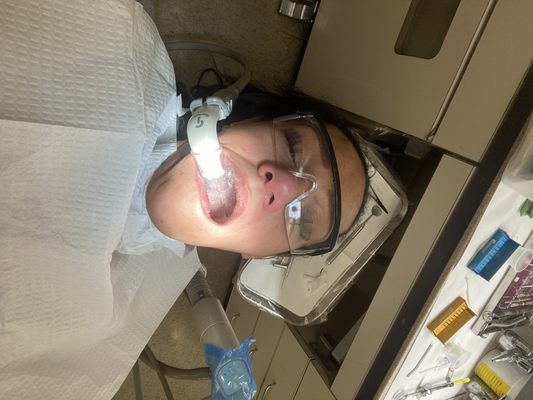 Me in the dentist chair while having the bridge removed!