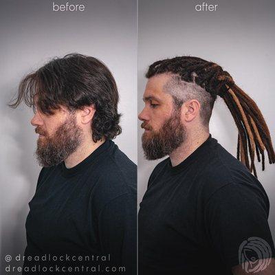 Dreadlock Extensions in Caucasian Undercut